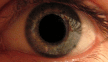 3,4-metilendioximetanfetamina 220px-Eye_dilate