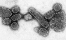 من الاعجاز القرآني  220px-Reconstructed_Spanish_Flu_Virus