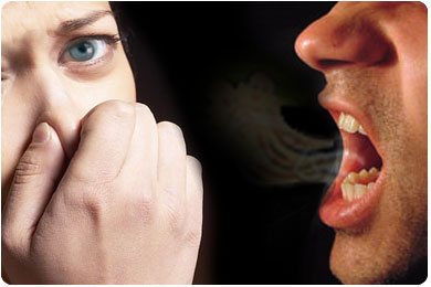 [Chia sẻ]-12 mẹo chữa hôi miệng đúng nhất Halitosis