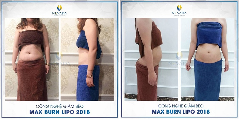 Giá giảm béo Max burn Lipo nevada Giam-beo1-1