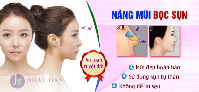 Nâng mũi với chất làm đầy hiệu quả Nang-mui-boc-sun-768x355