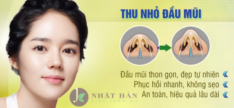 Phân biệt cách phẫu thuật nâng mũi nam và mũi nữ Thu-nho-dau-mui-1-768x355