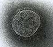 TỔNG QUAN VIRUS-Phạm Văn Ty - Nguyễn Lân Dũng Paramyxoviridae-02