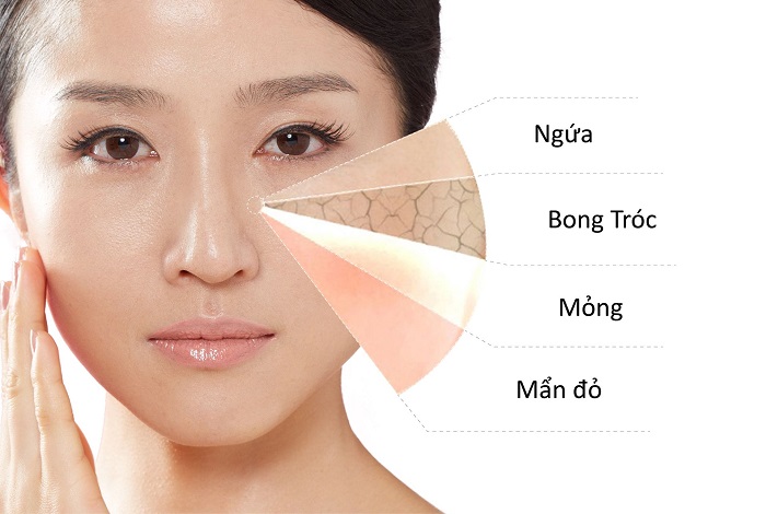 Tìm hiều về công dụng của kem nâng cơ mặt Lancome Kem-nang-co-mat-lancome-3