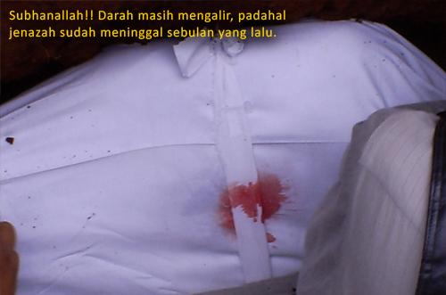 Hampir Satu Bulan Gugur, Darah Segar Masih Mengalir Dari Luka Para Muajhid Mujahid-tak-dikenal-2