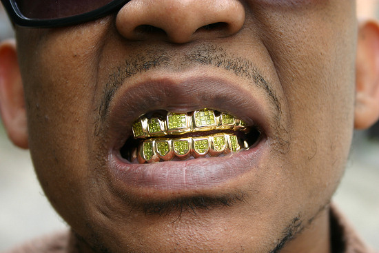 La vrai classe Goldteeth