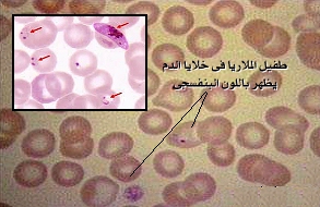 الملاريا   MALARIA 05