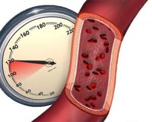 انخفاض ضغط الدم أسباب وأعراض وعلاج انخفاض ضغط الدم Bloodpressure-300x240