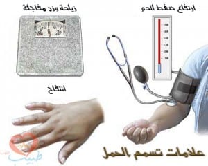 تسمم الحمل Preeclampsia %D8%B7%D8%A8%D9%8A%D8%A8-%D8%AD%D9%85%D9%84-300x240