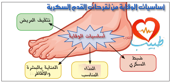 امراض القدمين واليدين %D8%B7%D8%A8%D9%8A%D8%A8-%D8%B9%D8%B1%D8%A8-%D8%B3%D9%83%D8%B1%D9%8A-%D9%82%D8%AF%D9%85