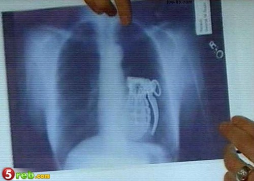 عجائب الصور PLOXray