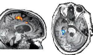 Logran comunicarse con pacientes en estado vegetativo Scan--300x180