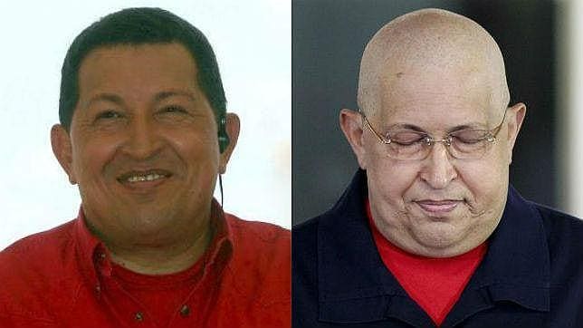 «Una inyección habría sido suficiente para inocular el cáncer a Chávez» Chavez-cancer-644x362--644x362