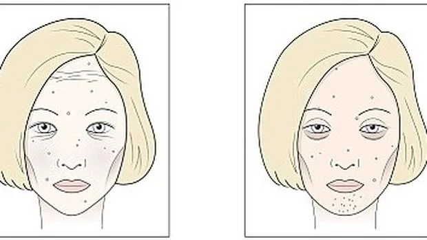 Así son los nefastos efectos del alcohol y el azúcar en tu rostro Adicciones-cara--620x349