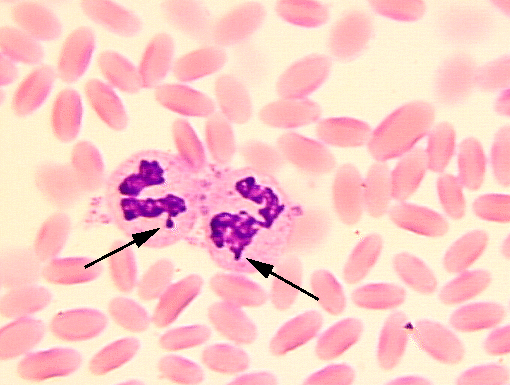 TD et TP n 1 immuno : Université d'oran Neutrbarr