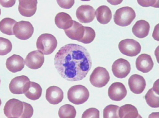 TD et TP n 1 immuno : Université d'oran Neutroph