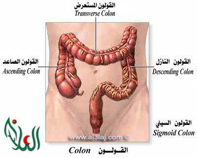 متلازمة القولون العصبي  Colon