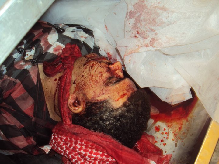 الى من اراد الحقيقه عن المظاهرات والقتل وكل ما يحدث في اليمن حالياً (الوجهه الحقيقي) 183729_187597241280337_179449562095105_460405_2134410_n