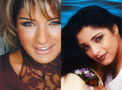 صور لفنانات عربيات قبل و بعد اجراء عمليات التجميل 11