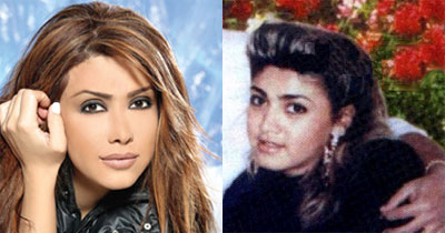 صور لفنانات عربيات قبل و بعد اجراء عمليات التجميل 13