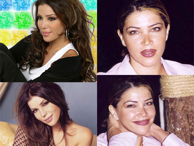 صور لفنانات عربيات قبل و بعد اجراء عمليات التجميل 20