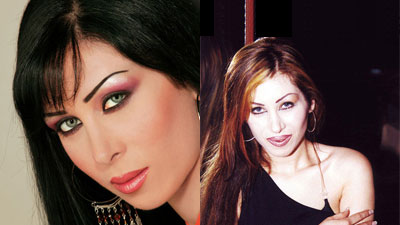 صور لفنانات عربيات قبل و بعد اجراء عمليات التجميل 21