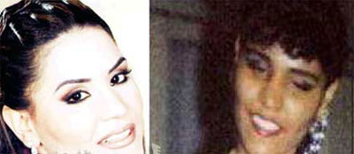 صور لفنانات عربيات قبل و بعد اجراء عمليات التجميل 30