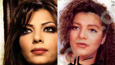 صور لفنانات عربيات قبل و بعد اجراء عمليات التجميل 34