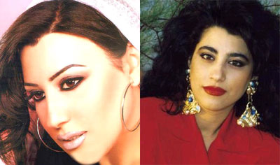 صور لفنانات عربيات قبل و بعد اجراء عمليات التجميل 7