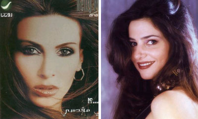 صور لفنانات عربيات قبل و بعد اجراء عمليات التجميل 8