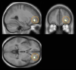 La Meditación Fortalece el Cerebro 120609a