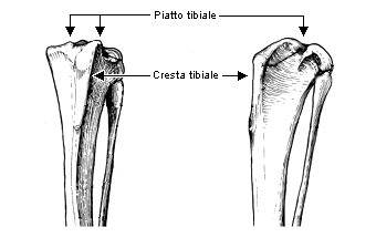 lussazione della rotula TPC02