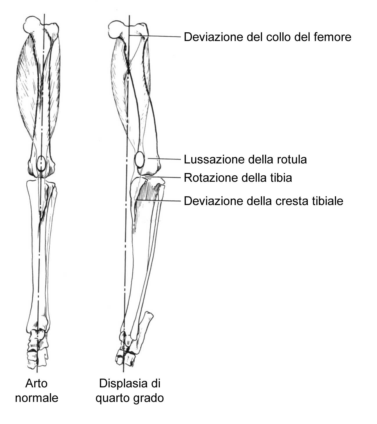 lussazione della rotula TPC06