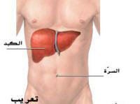 فيروسات الكبد .. أنواعها وطرق علاجها والوقاية منها 1332_9999999999999999999999999999999