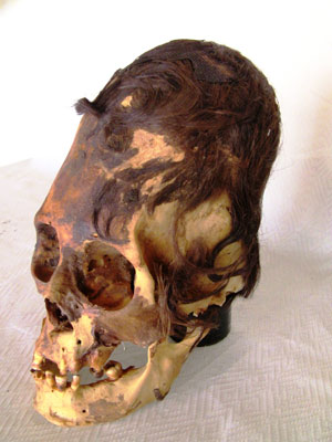  Elongated Human Skulls of Peru: Possible Evidence of a Lost Human Species? Paracas-skull-with-extreme-deformation