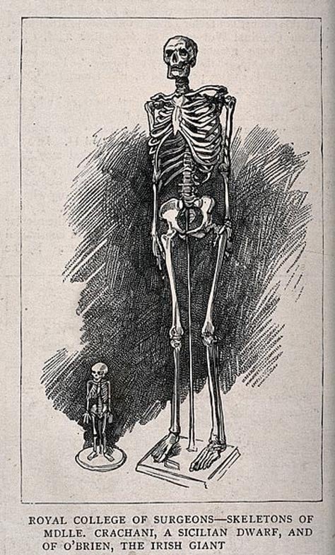 The Establishment Has Already Acknowledged a Lost Race of Giants   Skeletons-of-a-male-giant-and-a-female-dwarf