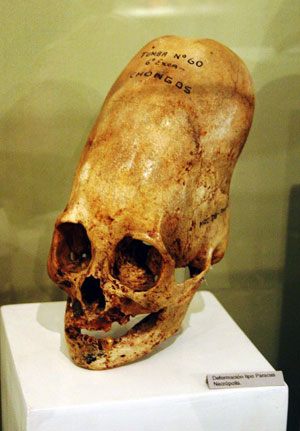  Elongated Human Skulls of Peru: Possible Evidence of a Lost Human Species? Museum-skull