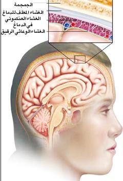 التهاب السحايا 115015_as_main