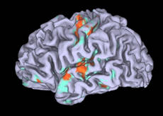 CERVELLO, L'INVIDIA FA MALE QUANTO UN DOLORE 5a8c7be8c3aa200539cb7fda97d03d60