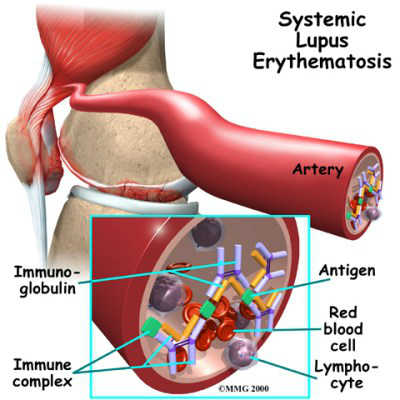 أمراض فشل فيها الطب الحدبث .Diseases in which medicine failed Alhaddth. 3-003