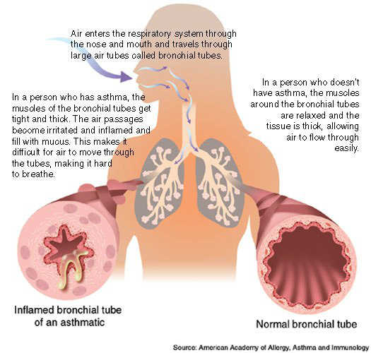 أمراض فشل فيها الطب الحدبث .Diseases in which medicine failed Alhaddth. 8-008