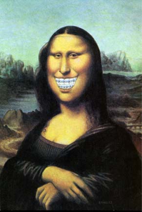 موناليزا بكل انووواعهاااا هههههههه Mona-teeth