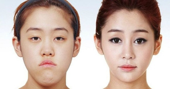  صور غير معقولة لكوريين قبل وبعد عمليات التجميل Korean-before-after-12