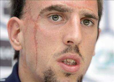 Is Cristiano Ronaldo the most handsome footballer in the history of the game? - Page 2 Ribery1