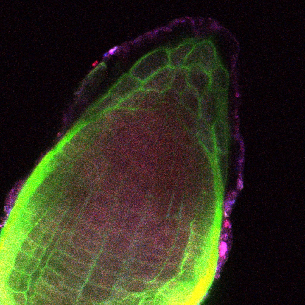 A human impact on nature : Plant Manipulation  Azospirillumdetection