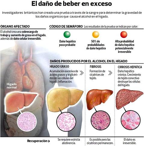 Consejos para cuidar nuestro hígado Alcoholismo