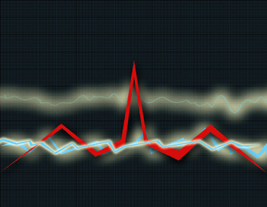 هل تعرف متى يموت قلبك؟؟ Ii_heart_attack