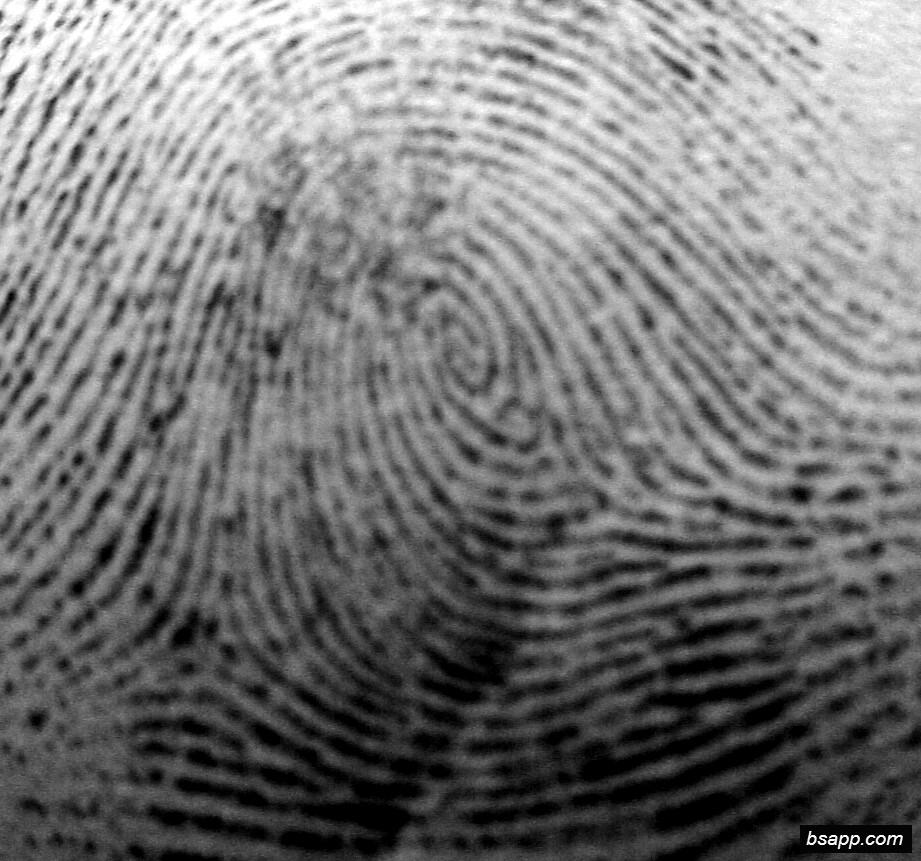 Psychological and diagnostic significance of finger prints DSC01009