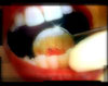 التهاب الأسنان والفم يؤدي إلى الإصابة بالروماتيزم Teeth_rhue