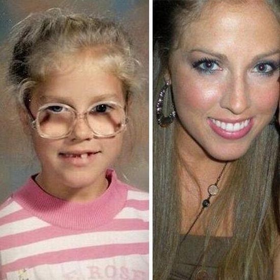 Imagens = Antes e depois ... (dai eu nunca falar mal de 1 mulher feia lol) Patinho-feio-15